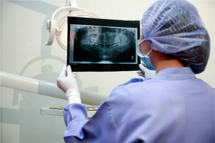 Dental professional examining a panoramic X-ray image to assess oral health and treatment planning needs.