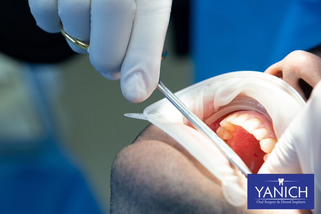 Dental surgeon performing oral procedure on patient using surgical instruments in a modern clinical setting.