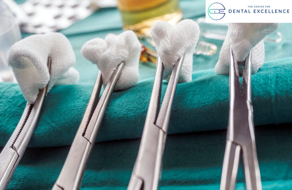 Sterile dental forceps holding gauze pads on a surgical tray prepared for oral surgery or tooth extraction procedures.