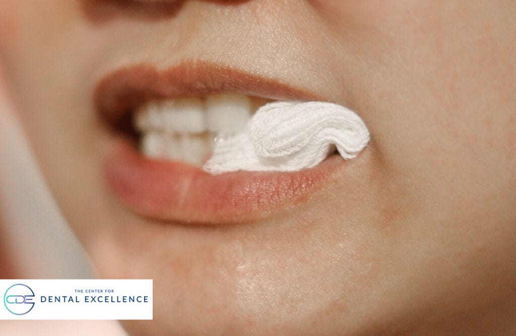Close-up view of mouth with gauze placed over extraction site, demonstrating proper post-surgery care following a tooth removal.